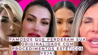 FAMOSOS QUE PERDERAM SUA ORIGINALIDADE COM PROCEDIMENTOS ESTÉTICOS