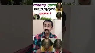 റോസ്മേരി വാട്ടർ പുരട്ടിയാൽ തലമുടി വളരുന്നത് എങ്ങനെ ? Rosemary Water for Hair Growth