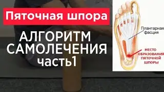 Пяточная шпора.Самомассаж в домашних условиях. Триггерные точки