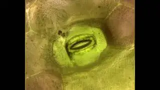 Estoma / Stoma