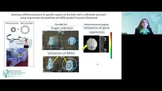 Beata Chertok: Immunotherapy of Brain Tumors via US-Targeted Delivery of Antibody-Encoding mRNA