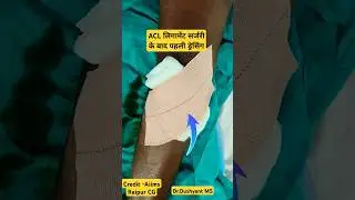 1st Dressing After Ligament Operation  ड्रेसिंग कैसे किया गया |#acl#kneeligament #woundcare #acltear