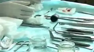 Операция пластика носа и век