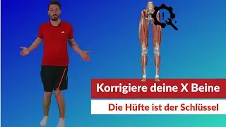 X Beine aus Hüftfehlstellung loswerden - so geht's! Training + Ursachentest