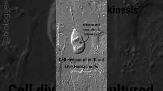 Live Human Cell Division under Microscope