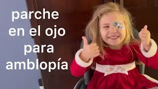 Cómo usar un parche en el ojo para la ambliopía o el ojo vago
