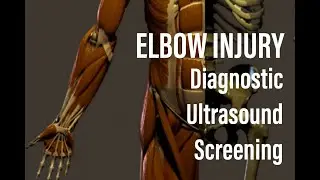 Elbow Diagnostic Ultrasound Post-Injury, Fracture or something else?