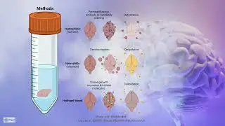 I Can See Clearly Now, The Brain is Gone