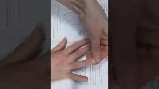 Су джок семянотерапия про воспалении мочевого пузыря и недержании мочи. #суджок #недержание #цистит