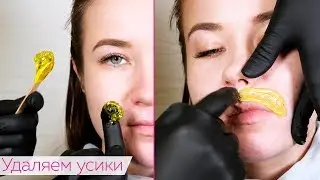 Moustache Hair Removal for Women / Moustache Sugaring by Yana Osadchaya