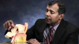 Types of Hearing Loss