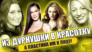 THE MAIN SECRET of beauty? GOOD plastic surgery
