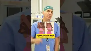 How to tell if you have breast cancer 
