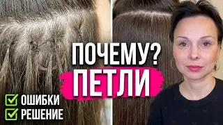 Причины появления петель.