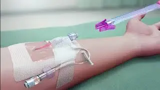 PIVO™ Needle-free Blood Collection Device:  Straight IV Catheter System