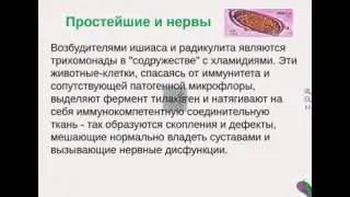 Радикулит и невралгия. Лечение без лекарств