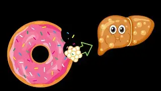 Conoce como la GRASA y el AZUCAR de una DONUT afectan a tu hígado