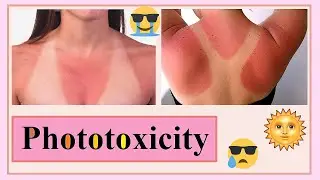 phototoxicity