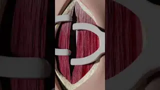 Tracheotomy Surgery Explained 3D Animation