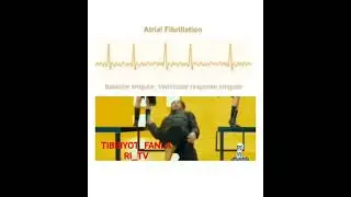 EKG haqida