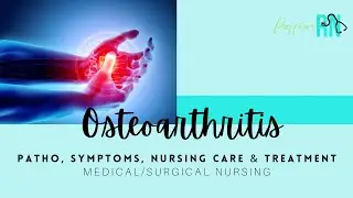 Osteoarthritis / Med-Surg Nursing / INCLUDES practice questions w/rationale!