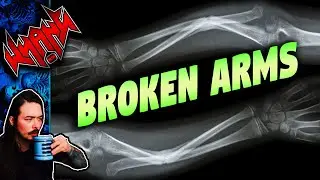 The Reddit Broken Arms Story is Worse than I Remember - Tales From the Internet