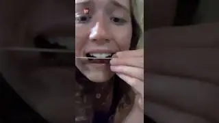 teeth Filing Trend In America