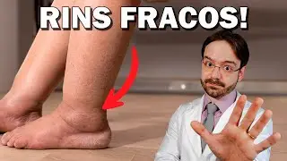 7 Sinais Que Seu Rim Não Vai Bem!
