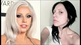 CELEBRİTİES WİTHOUT MAKE UP
