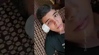 Un palestinien a perdu un œil, un pied et une main à cause du génocide israélien en cours à #Gaza.