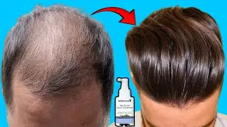 Top Hair Serum After 15 Days Review | Best Hair Growth Serum For Thin Hair in India 2025 !