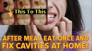 The SECRET to Reverse Tooth Cavities Naturally - Chew This After Meals