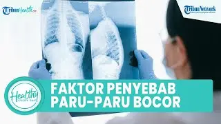 Faktor Risiko Seseorang Alami Paru-Paru Bocor Bisa Picu Kematian, Ini 4 Penyebab dan Cara Mencegah