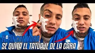 El Pinche Mara Se Quitó El Tatuaje de la Cara 2018 | Aclaraciones