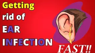Ear pain relief treatments that you can do at home
