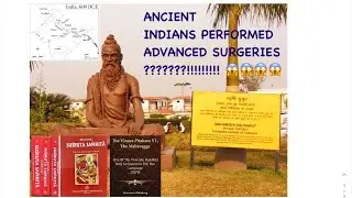 Did ancient Indians perform advanced surgeries? | Surgery in Ancient India | Sigmoid Volvulus