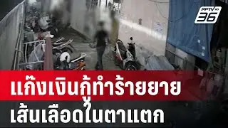 ยายวัย 72 ปี ร้องแก๊งเงินกู้ทำร้ายเส้นเลือดในตาแตก | เที่ยงทันข่าว | 27 ก.ค. 67
