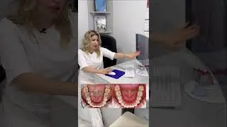 Разбор клинического случая | стоматолог ортодонт Москва