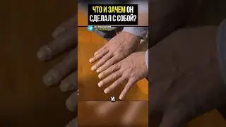 А ты занимаешься...самолечением? #лекарства #отравление