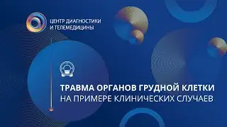 Травма органов грудной клетки на примере клинических случаев
