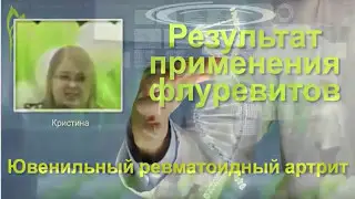 Ревматоидный артрит.Отзыв из Омска