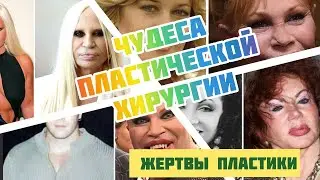 Звезды- жертвы пластической хирургии/ пластика во вред