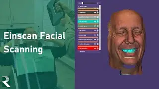 Einscan Facial Scanning