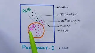 Erythroblastosis fetalis | Hemolytic anemia | Rh incompatibility | Symptoms | Bio science