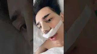 iiih bb star fait opération du nez 🤭