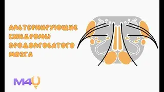 Альтернирующие синдромы продолговатого мозга