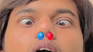 m&m stuck in nose