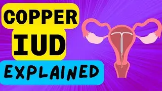 COPPER IUD EXPLAINED - INTRAUTERINE DEVICE - WHAT IS IT AND HOW IT WORKS!