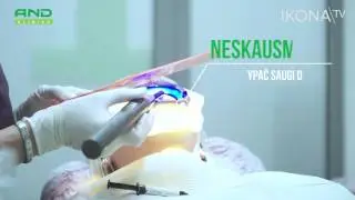 Naujovė dantų balinimo srityje! TIK 