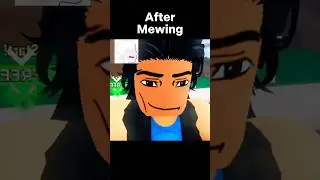 Mewing Transformation